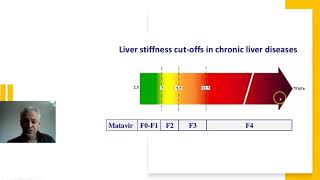 liver fibroscans explained [upl. by Yesnik]