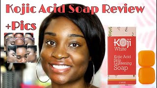 SKIN LIGHTENING SOAP Koji White Kojic Acid Skin Lightening Soap Review  BeautyByAJ [upl. by Weismann562]