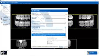 Training Apteryx XrayVision DCV Exporting Images [upl. by Oina217]