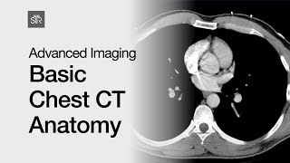 Advanced Imaging Basic Chest CT Anatomy [upl. by Yenahc179]