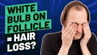 White Bulb on Hair Follicle What Does It Mean [upl. by Aceber]