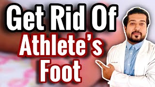 How to Treat Athletes Foot FOR GOOD 2021 [upl. by Lleret]