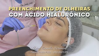 Preenchimento de Olheiras com Ácido Hialurônico  Harmonização Facial  Tratamento para olheiras [upl. by Plusch]