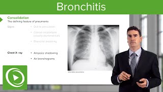 Bronchitis Treatment Options [upl. by Elbon]