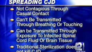 WingBeating Tremor in CreutzfeldtJakob Disease CJD [upl. by Enak]