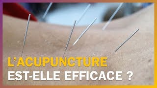 Lacupuncture estelle efficace [upl. by Eissej311]