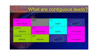 STEMI and NSTEMI Coding – How to Tell The Difference [upl. by Netsrik820]