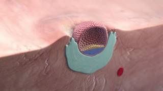 Implantation of the blastocyst [upl. by Chaille]