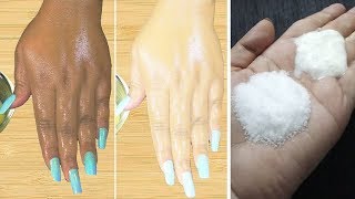 5 DIY FACE MASKS for flawless skin  Homemade Natural ACNE remedies  Anti Ageing etc  PEACHY [upl. by Eijneb]