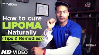 What Is Lipoma लाइपोमा  How to cure LIPOMA Naturally  Tips by Guru Mann [upl. by Embry757]