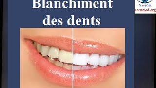 Blanchiment des dents techniques [upl. by Cirded]