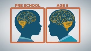 How baby brains develop [upl. by Rianon]