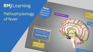 Pathophysiology of fever explained [upl. by Wise]