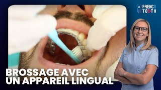 Comment se brosser les dents avec un appareil lingual   Dr Marie Medio [upl. by Agatha]