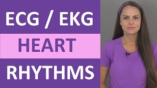 EKG Rhythms  ECG Heart Rhythms Explained  Comprehensive NCLEX Review [upl. by Airdni]