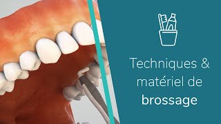 Comment utiliser les brossettes interdentaires [upl. by Asilej65]