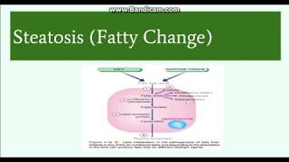 Splenomegaly Remember the 3 primary causes with CIP [upl. by Nasaj]