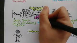 Circulatory Shock  Types and Causes [upl. by Cottrell226]