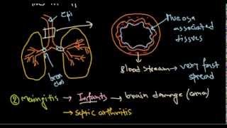 Haemophilus influenzae infection [upl. by Anyl]