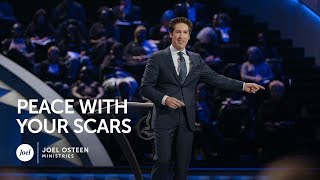 Joel Osteen  Peace With Your Scars [upl. by Willis]