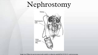 Nephrostomy [upl. by Adianes]