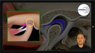 Ressonância Magnética da Articulação Temporomandibular [upl. by Drucill199]