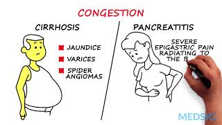 Identifying cholestasis on your liver labs panel [upl. by Barnard]