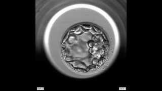 EmbryoScope Embryo Development  Blastocyst [upl. by Alokin]