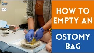 Emptying an Ostomy Bag [upl. by Crichton339]