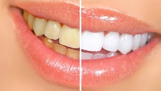 Comment blanchir ses dents naturellement  Oil pulling [upl. by Smeaj825]