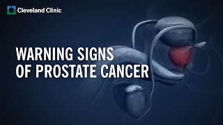 10 Warning Signs of Prostate Cancer [upl. by Nonnaihr]