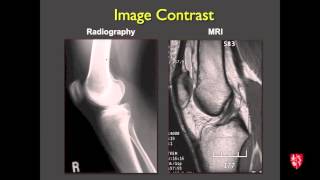 Medical Student Lecture Introduction to Musculoskeletal Imaging [upl. by Ettore104]