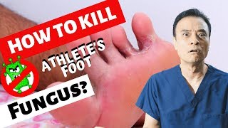 How to kill athletes foot fungus [upl. by Aoh654]