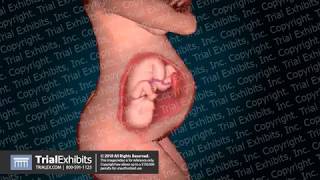 Fetal Circulation v Neonatal Circulation [upl. by Fridlund]