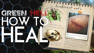 Green Hell  How to HEAL any condition [upl. by Tterrag]