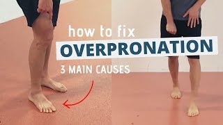 Pronated Feet and How to Fix 3 Different Causes of OVERPRONATION [upl. by Arela]