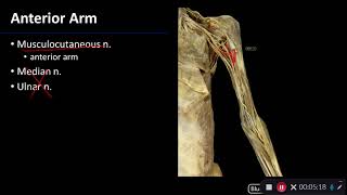 Nerves Overview of Upper Limb  Dissection Supplement [upl. by Jorrie42]