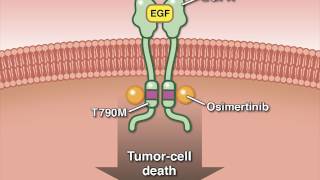 Osimertinib in Advanced Non–SmallCell Lung Cancer [upl. by Analra]