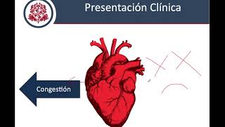 Insuficiencia Cardiaca  Fisiopatología Clínica y Diagnostico [upl. by Atteuqnas]