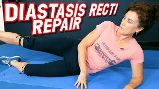 Top 5 Exercises to REPAIR Diastasis Recti [upl. by Price]