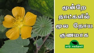 மூன்றே நாட்களில் மூல நோய் குணமாக  Thuthi ilai uses in Tamil  Abutilon Indicum for Piles [upl. by Chrysler175]