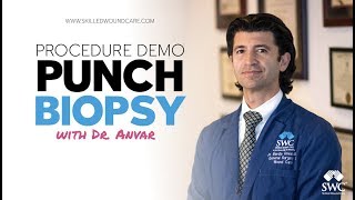 Punch Biopsy Demo  Skilled Wound Care [upl. by Briney36]