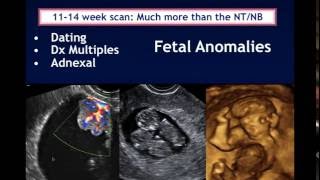 AIUM Webinar Systematic Evaluation of the 1114 Week Fetus Touching on ISUOG Guidelines [upl. by Naret46]