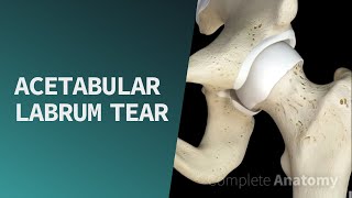 How to Manipulate HVT the lumbar spine of L4L5 amp L5S1 [upl. by Enyallij]