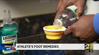 How to help knock out Athletes Foot [upl. by Lancelot]