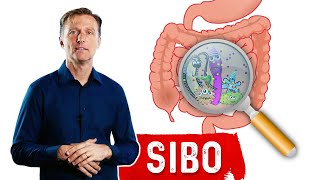 What Is SIBO  common signs and symptoms [upl. by Eimmak]