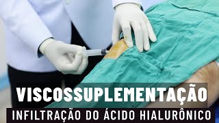 INFILTRAÇÃO NO JOELHO DO ÁCIDO HIALURÔNICO VISCOSSUPLEMENTAÇÃO parte 1 [upl. by Lemcke]