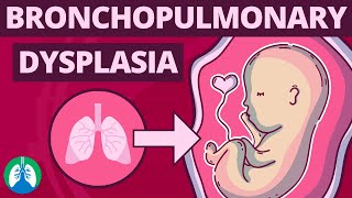 Bronchopulmonary Dysplasia BPD  Medical Definition and Explainer Video [upl. by Jermaine]