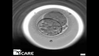 Time Lapse Embryo Imaging [upl. by Acim807]