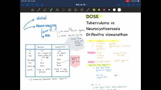 DOSE Tuberculoma vs NCC [upl. by Haisi]